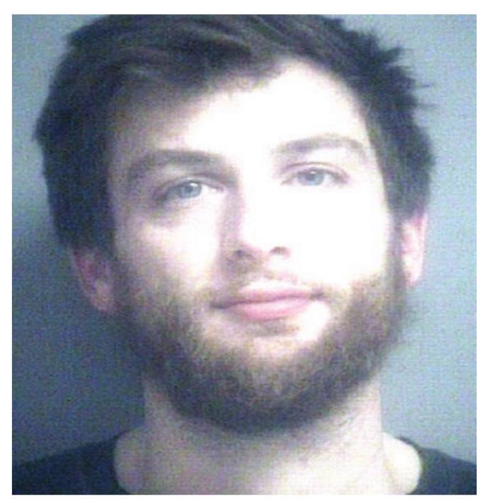Man commits battery on hotel guest